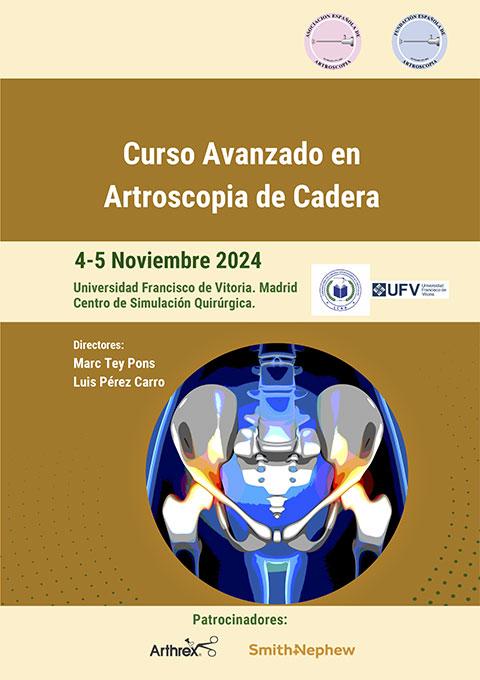 Curso Avanzado en Artroscopia de cadera